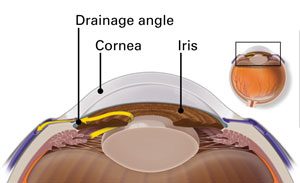 Drainage-angle-outflow-healthy-eye-300px