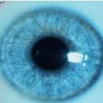 lamellar_02